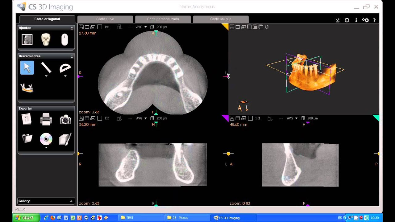 Carestream 3d imaging software download